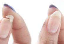 Tırnak Kırılmasının Nedenleri