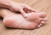 Ayaklarda Nasır Sorunu