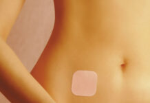 Doğum Kontrol Bandı