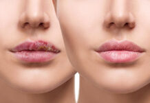 Dudaklar İçin Bakım Önerileri