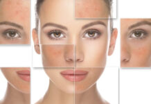 Hassas Cilt ve Özellikleri