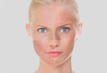 Hassas Cilt Yapısı Nasıl Anlaşılır