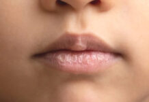 Kış Aylarında Dudak Bakımı