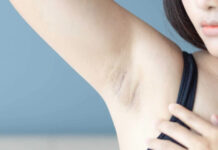 Koltuk Altı Kararması