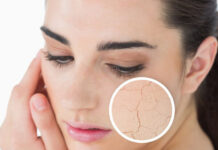 Kuru Cilt ve Özellikleri