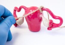 Tüp Bağlanması Nedir